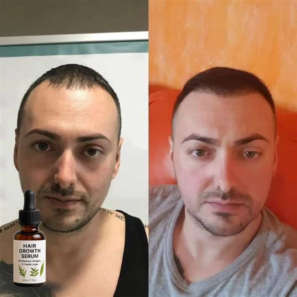 Firmelià Serum po Zabiegu Stymulujący Odrost Włosów